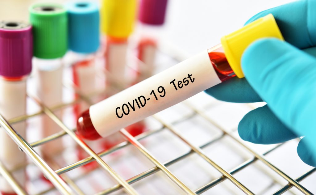 Coronavirus: Brazilian Start-up Contributes to Coronavirus War with Rapid Development of COVID-19 Test